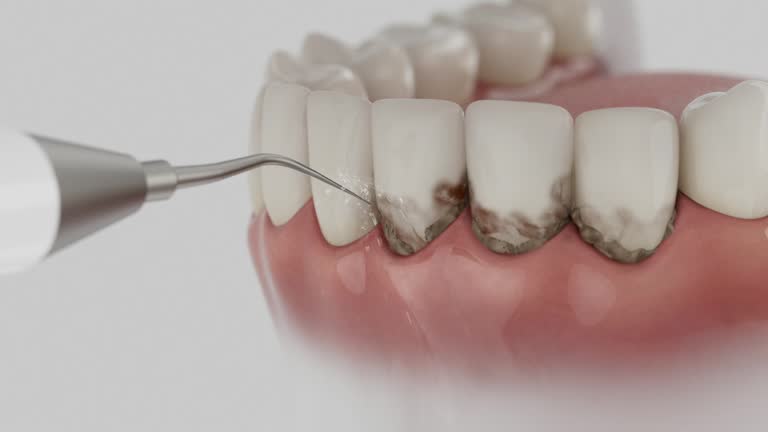 Reliable Emergency Dentist contractor in Horace, ND by Smile Center Dentistry